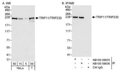 Western Blot: Thyroid receptor-interacting protein 11 Antibody [NB100-59836] - Detection of Human TRIP11/TRIP230 on HeLa whole cell lysate using NB100-59836. TRIP11/TRIP230 was also immunoprecipitated by rabbit anti-TRIP11/TRIP230 antibody NB100-59835.