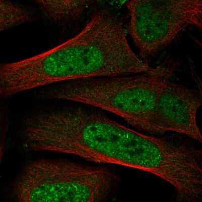 Immunocytochemistry/Immunofluorescence: Thyroid receptor-interacting protein 12 Antibody [NBP2-34035] - Staining of human cell line U-2 OS shows localization to nuclear speckles.