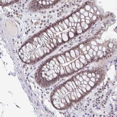 <b>Orthogonal Strategies Validation. </b>Immunohistochemistry: Thyroid receptor-interacting protein 12 Antibody [NBP2-33450] - Staining of human colon shows moderate nuclear positivity in glandular cells.