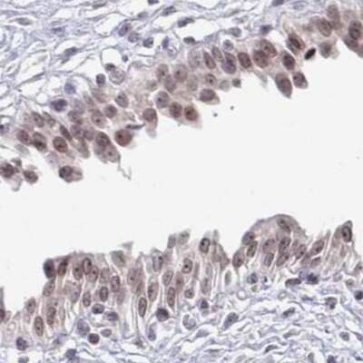 Immunohistochemistry: Thyroid receptor-interacting protein 12 Antibody [NBP2-33450] - Staining of urinary bladder