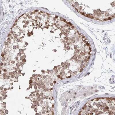 Immunohistochemistry-Paraffin: Thyroid receptor-interacting protein 12 Antibody [NBP2-33450] - Staining of human testis shows high expression.