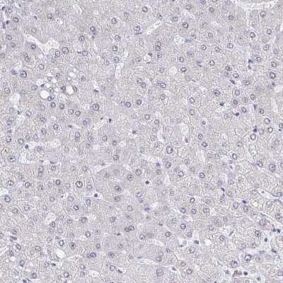 Immunohistochemistry-Paraffin: Thyroid receptor-interacting protein 12 Antibody [NBP2-34035] - Staining of human liver shows no positivity in hepatocytes as expected.