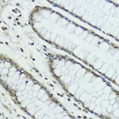 Immunohistochemistry-Paraffin: Thyroid receptor-interacting protein 12 Antibody [NBP2-94325] - Human colon using TRIP12 antibody at dilution of 1:100 (40x lens).