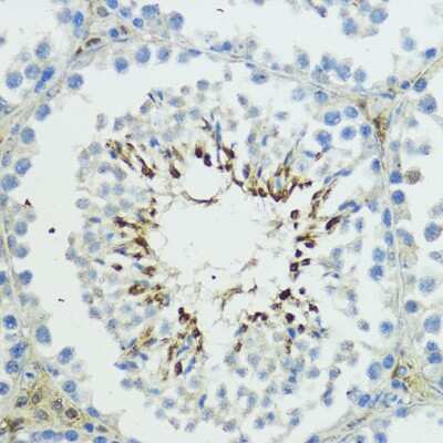 Immunohistochemistry-Paraffin: Thyroid receptor-interacting protein 12 Antibody [NBP2-94325] - Mouse testis using TRIP12 antibody at dilution of 1:100 (40x lens).