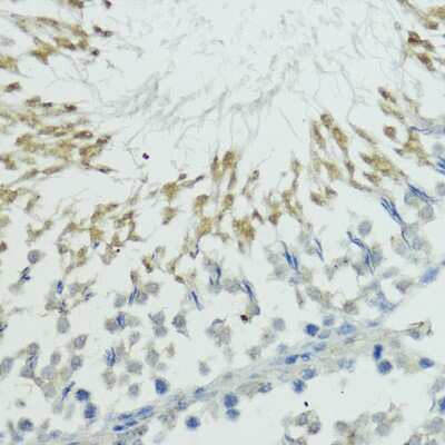 Immunohistochemistry-Paraffin: Thyroid receptor-interacting protein 12 Antibody [NBP2-94325] - Rat testis using TRIP12 antibody at dilution of 1:100 (40x lens).