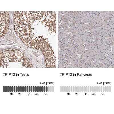 Immunohistochemistry-Paraffin: Thyroid receptor-interacting protein 13 Antibody [NBP1-90335] - Staining in human testis and pancreas tissues using anti-TRIP13 antibody. Corresponding TRIP13 RNA-seq data are presented for the same tissues.