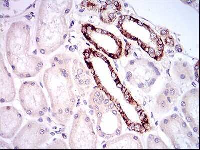 Immunohistochemistry: Tie-1 Antibody (8D12D2) [NBP2-37267] - Immunohistochemical analysis of paraffin-embedded kidney tissues using TIE1 mouse mAb with DAB staining.