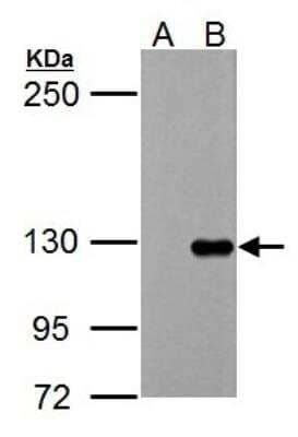 Western Blot: Tie-1 Antibody [NBP2-20635] - A. 30 ug 293T whole cell lysate/extractB. 30 ug whole cell lysate/extract of human Tie-1-transfected 293T cells5 % SDS-PAGE Tie-1 antibody dilution: 1:5000.