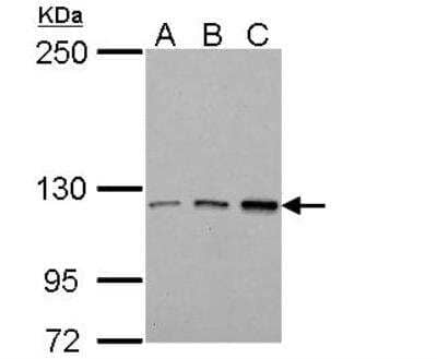 Western Blot: Tie-1 Antibody [NBP2-20635] - Analysis. A. 30 ug Jurkat whole cell lysate/extract B. 30 ug Raji whole cell lysate/extract C. 30 ug K562 whole cell lysate/extract 5 % SDS-PAGE  dilution: 1:1000