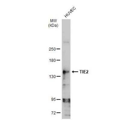 Western Blot: Tie-2 Antibody [NBP2-20636] - Whole cell extract (30 ug) was separated by 5% SDS-PAGE, and the membrane was blotted with TIE2 antibody diluted at 1:500. The HRP-conjugated anti-rabbit IgG antibody (NBP2-19301) was used to detect the primary antibody.