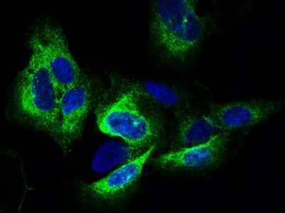 Immunocytochemistry/Immunofluorescence: Tight Junction Protein 1 Antibody [NBP2-99094] - Immunofluorescence staining of Tight Junction Protein 1 in U2OS cells. Cells were fixed with 4% PFA, permeabilzed with 0.3% Triton X-100 in PBS, blocked with 10% serum, and incubated with rabbit anti- Tight Junction Protein 1 polyclonal antibody (dilution ratio 1:1000) at 4C overnight. Then cells were stained with the Alexa Fluor(R)488-conjugated Goat Anti-rabbit IgG secondary antibody (green) and counterstained with DAPI (blue). Positive staining was localized to cytoplasm.