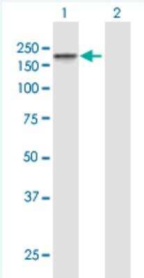 Western Blot: Tight Junction Protein 2 Antibody [H00009414-B01P-50ug] -  Analysis of TJP2 expression in transfected 293T cell line (H00009414-T01) by TJP2 MaxPab polyclonal antibody.  Lane 1: TJP2 transfected lysate(130.9 KDa). Lane 2: Non-transfected lysate.
