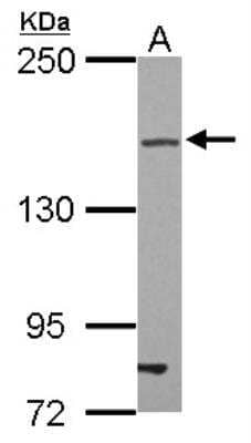 Western Blot: Tight Junction Protein 2 Antibody [NBP2-20641] - Tight junction protein 2 Antibody [NBP2-20641] - Sample (30 ug of whole cell lysate) A: U87-MG 5% SDS PAGE gel, diluted at 1:500.