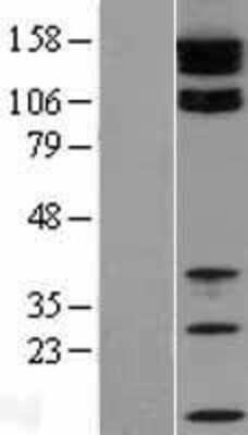 Western Blot Tight Junction Protein 2 Overexpression Lysate