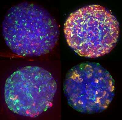 Tissue Clearing Pro-Organoid [7390-NOV] - Kit (Cat. No 7390-NOV) was applied to Open Liver HepaRG NP spheroids, allowing visualization of stained structures: Upper left DNA, MRPII and MDRI; Upper right DNA, CD68, Albumin and Vimentin; Lower Left DNA, panCK and CD31; Lower right Right DNA, panCK and Cytochrome P450 3A4.