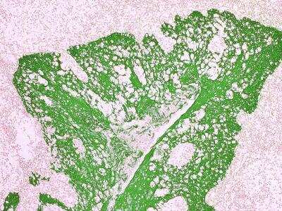 Immunohistochemistry-Paraffin: Tissue Glue Kit [NBP3-12174] - Formalin fixed paraffin embedded human Tonsil stained with Cytokeratin antibody using Tissue Glue (NBP3-12174)