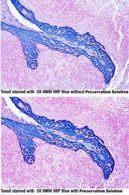 Tissue Preservation Solution - HRP/AP assays [NBP3-12178]