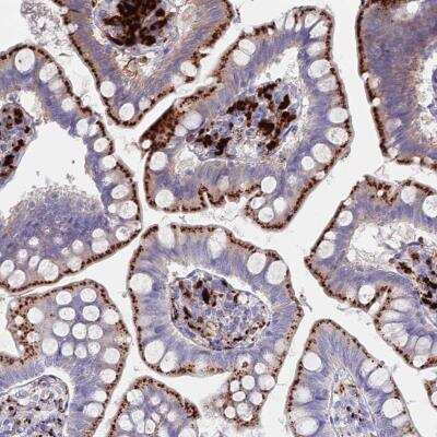 Immunohistochemistry: Tissue alpha-L-Fucosidase/FUCA1 Antibody [NBP2-32044] - Immunohistochemical staining of human small intestine shows strong lysosome positivity in glandular cells.