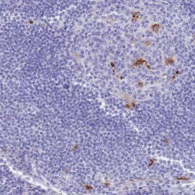 Immunohistochemistry-Paraffin: Tissue alpha-L-Fucosidase/FUCA1 Antibody [NBP2-32044] - Staining of human lymph node shows high expression.