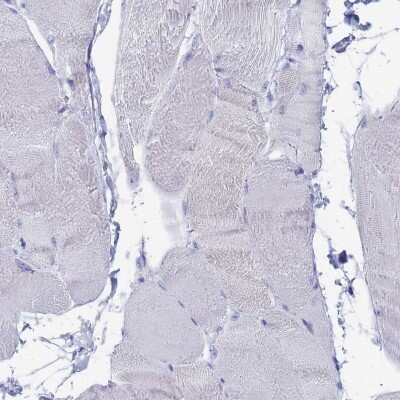 Immunohistochemistry-Paraffin: Tissue alpha-L-Fucosidase/FUCA1 Antibody [NBP2-32044] - Staining of human skeletal muscle shows low expression as expected.