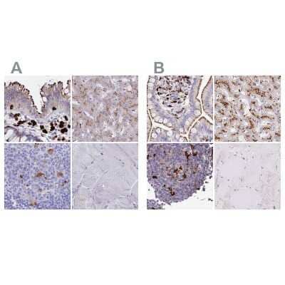 <b>Independent Antibodies Validation. </b>Immunohistochemistry-Paraffin: Tissue alpha-L-Fucosidase/FUCA1 Antibody [NBP2-32044] - Staining of human colon, liver, lymph node and skeletal muscle using Anti-FUCA1 antibody NBP2-32044 (A) shows similar protein distribution across tissues to independent antibody NBP2-58170 (B).