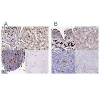 <b>Independent Antibodies Validation and Orthogonal Strategies Validation.</b>Immunohistochemistry-Paraffin: Tissue alpha-L-Fucosidase/FUCA1 Antibody [NBP2-58170] - Staining of human colon, liver, lymph node and skeletal muscle using Anti-FUCA1 antibody NBP2-58170 (A) shows similar protein distribution across tissues to independent antibody NBP2-32044 (B).