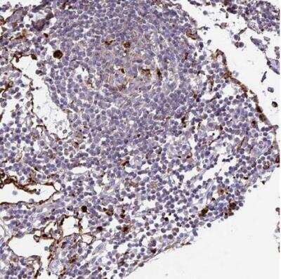 Immunohistochemistry-Paraffin: Tissue alpha-L-Fucosidase/FUCA1 Antibody [NBP2-58170] - Staining of human lymph node shows strong granular cytoplasmic positivity in germinal center cells.