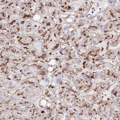 Immunohistochemistry-Paraffin: Tissue alpha-L-Fucosidase/FUCA1 Antibody [NBP2-58170] - Staining of human liver shows strong granular cytoplasmic positivity in hepatocytes.