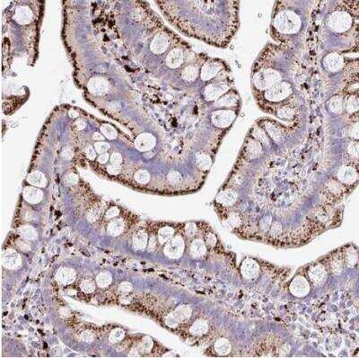 Immunohistochemistry-Paraffin: Tissue alpha-L-Fucosidase/FUCA1 Antibody [NBP2-58170] - Staining of human small intestine shows strong granular cytoplasmic positivity in glandular cells.