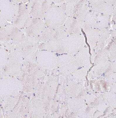 Immunohistochemistry-Paraffin: Tissue alpha-L-Fucosidase/FUCA1 Antibody [NBP2-58170] - Staining of human skeltal muscle shows no positivity in myocytes as expected.