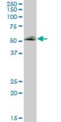 Western Blot: Tissue alpha-L-Fucosidase/FUCA1 Antibody [H00002517-B01P] - Analysis of FUCA1 expression in human spleen.