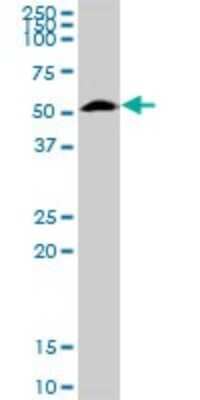Western Blot: Tissue alpha-L-Fucosidase/FUCA1 Antibody [H00002517-D01P] - Analysis of FUCA1 expression in mouse brain.
