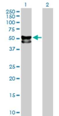 Western Blot: Tissue alpha-L-Fucosidase/FUCA1 Antibody [H00002517-D01P] - Analysis of FUCA1 expression in transfected 293T cell line by FUCA1 polyclonal antibody.Lane 1: FUCA1 transfected lysate(53.20 KDa).Lane 2: Non-transfected lysate.