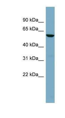 Western Blot: Tissue alpha-L-Fucosidase/FUCA1 Antibody [NBP1-57993] - HT1080 cell lysate, concentration 0.2-1 ug/ml.