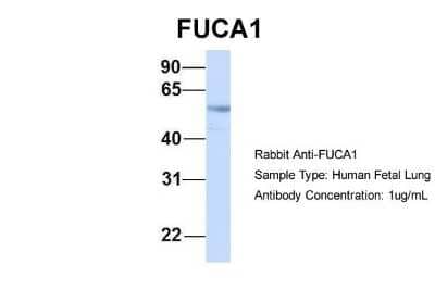 Western Blot: Tissue alpha-L-Fucosidase/FUCA1 Antibody [NBP1-57993] - Human Fetal Lung, Antibody Dilution: 1.0 ug/ml.