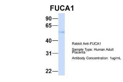 Western Blot: Tissue alpha-L-Fucosidase/FUCA1 Antibody [NBP1-57993] - Sample Type: Human Adult Placenta Antibody Dilution: 1.0 ug/ml