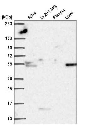 Western Blot: Tissue alpha-L-Fucosidase/FUCA1 Antibody [NBP2-58170] - Analysis in human cell line RT-4, human cell line U-251 MG, human plasma and human liver tissue.