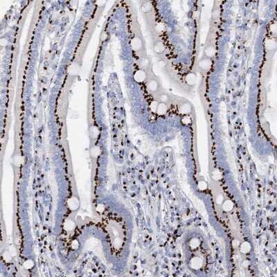 Immunohistochemistry-Paraffin: Tm9sf3 Antibody [NBP1-80736] - Staining of human duodenum shows strong granular cytoplasmic positivity in glandular cells.