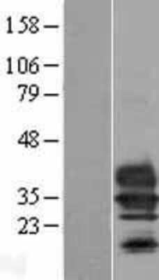 Western Blot: Tmem27 Overexpression Lysate (Adult Normal) [NBL1-17069] Left-Empty vector transfected control cell lysate (HEK293 cell lysate); Right -Over-expression Lysate for Tmem27.