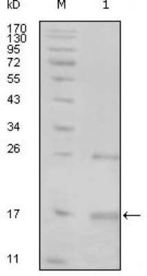 Western Blot: Tnk1 Antibody (1B5G3) [NBP1-47379] - Analysis using TNK1 mouse mAb against truncated TNK1-His recombinant protein (1).