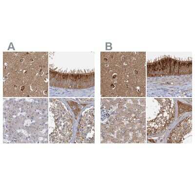 <b>Independent Antibodies Validation. </b>Immunohistochemistry-Paraffin: Tollip Antibody [NBP1-81596] - Staining of human cerebral cortex, epididymis, liver and testis using Anti-TOLLIP antibody NBP1-81596 (A) shows similar protein distribution across tissues to independent antibody NBP1-81597 (B).