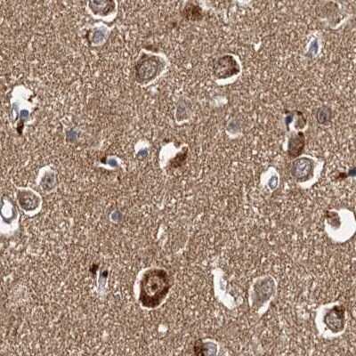 Immunohistochemistry-Paraffin: Tollip Antibody [NBP1-81596] - Staining of human cerebral cortex.