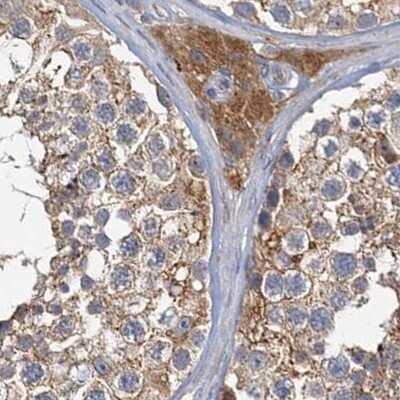 <b>Genetic Strategies Validation. </b>Immunohistochemistry-Paraffin: Tollip Antibody [NBP1-81596] - Staining of human testis.