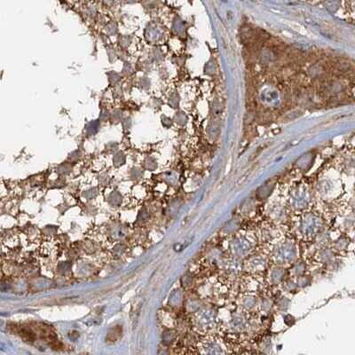 Immunohistochemistry-Paraffin: Tollip Antibody [NBP1-81597] - Staining of human testis.