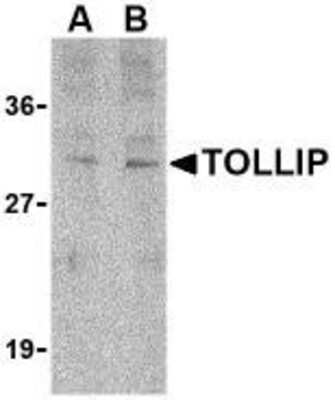 Western Blot: Tollip Antibody [NBP1-76681] - Rat brain cell lysate with TOLLIP antibody at (A) 1 and (B) 2 ug/ml.