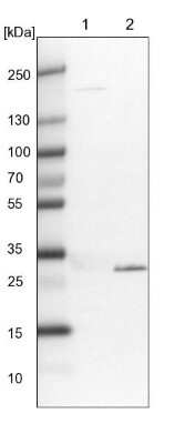 Western Blot: Tollip Antibody [NBP1-81596] - Lane 1: NIH-3T3 cell lysate (Mouse embryonic fibroblast cells)Lane 2: NBT-II cell lysate (Rat Wistar bladder tumour cells)