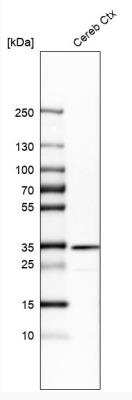 Western Blot Tollip Antibody