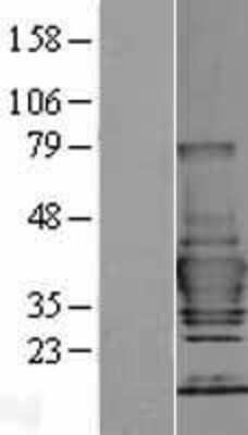 Western Blot Tollip Overexpression Lysate