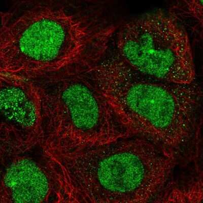 Immunocytochemistry/Immunofluorescence: TopBP1 Antibody [NBP2-55483] - Staining of human cell line A-431 shows localization to nucleus & nuclear bodies.