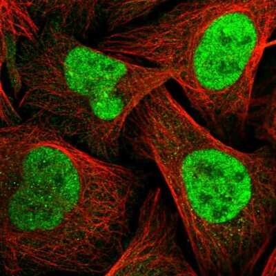 Immunocytochemistry/Immunofluorescence: TopBP1 Antibody [NBP2-55484] - Staining of human cell line U-2 OS shows localization to nucleus.